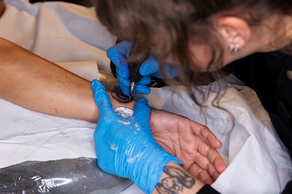 Everything You Need to Know About Laser Tattoo Removal in Dubai