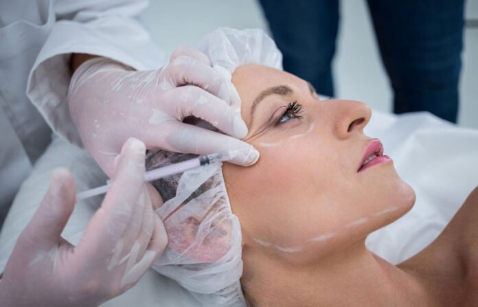 Is a Facelift Right for You?