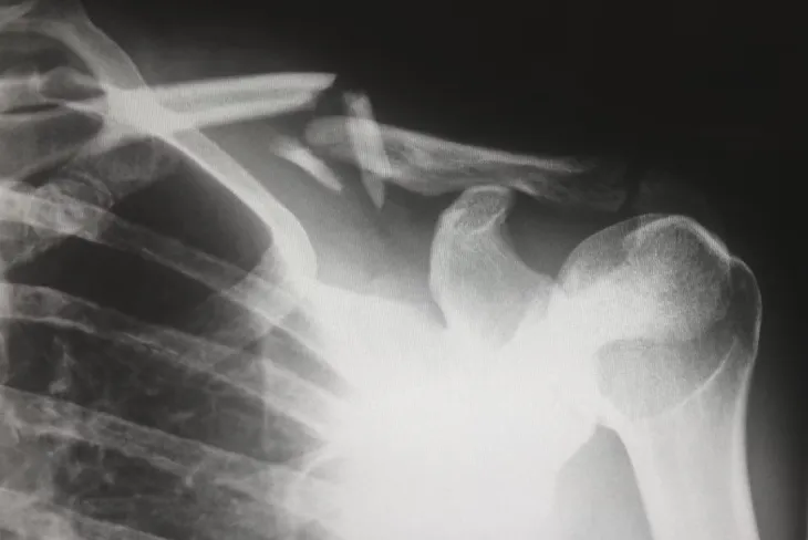 Consult a Medical Doctor