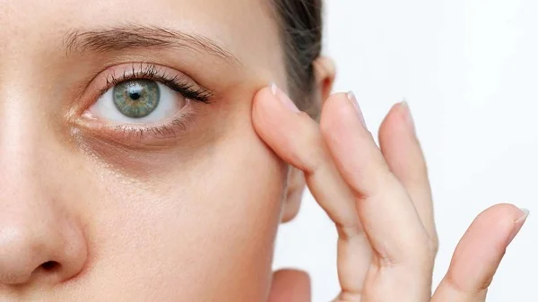 Say Goodbye to Dark Circles: Top Tips for Radiant Eyes